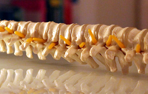 spinesmall1